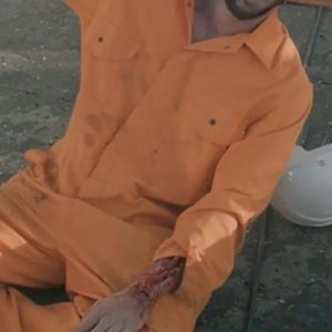 Elementary first aid, Shock